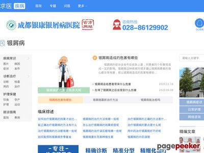 成都牛皮癣_银屑病医院